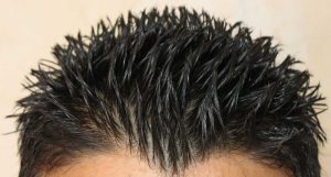 فردی به جای مو بر سر خود سبزی ترخون کاشته است!!